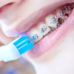 cuidado ral con la ortodoncia